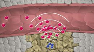 MIT's New Nanoparticles Tag Team Cancer Cells